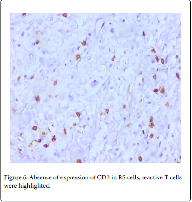blood-research-hematologic-absence