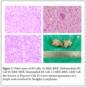 blood-research-hematologic-matted