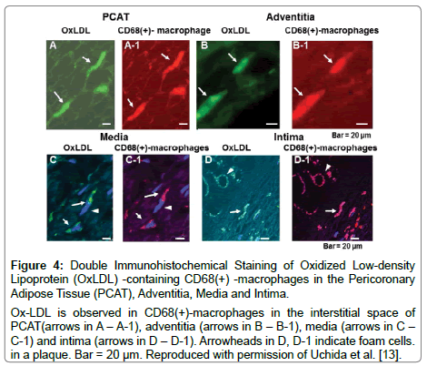 cardiovascular-research-Adipose-Tissue