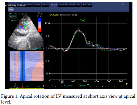 cardiovascular-research-Apical-rotation