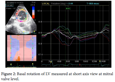 cardiovascular-research-Basal-rotation