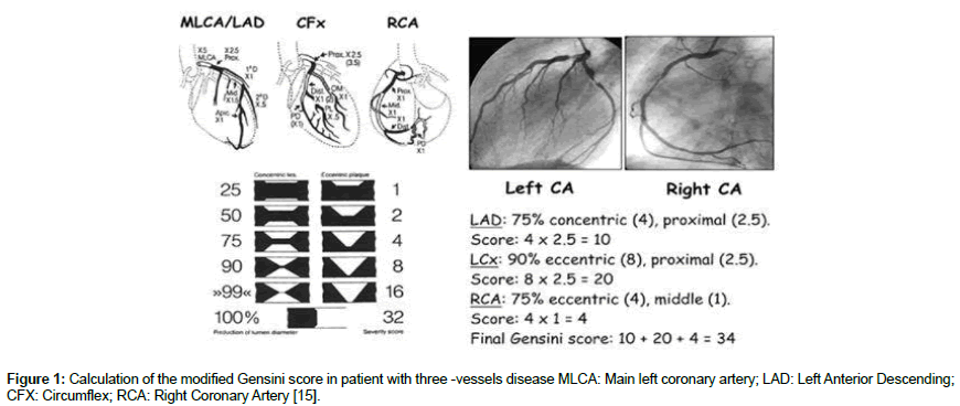 cardiovascular-research-Calculation