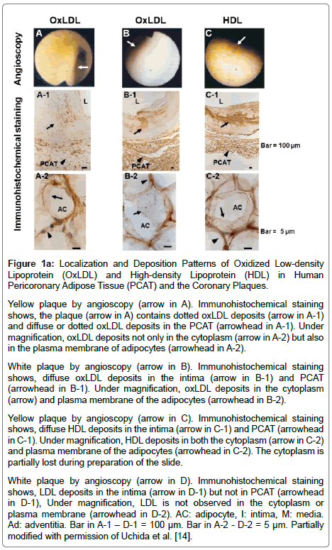 cardiovascular-research-Deposition-Patterns