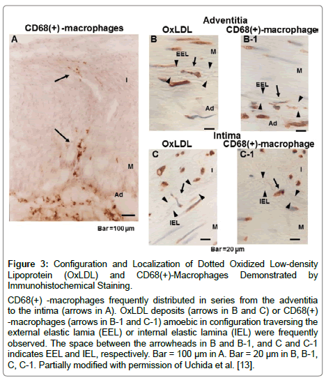 cardiovascular-research-Dotted-Oxidized