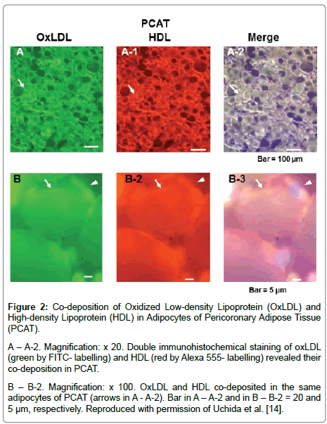 cardiovascular-research-High-density