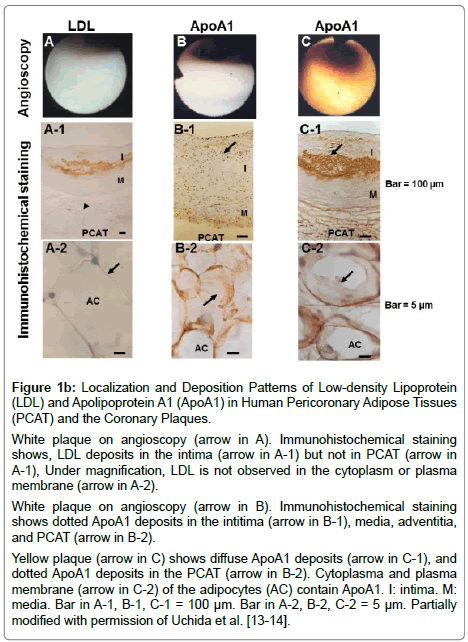 cardiovascular-research-Low-density