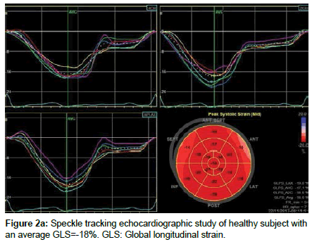 cardiovascular-research-Speckle-tracking