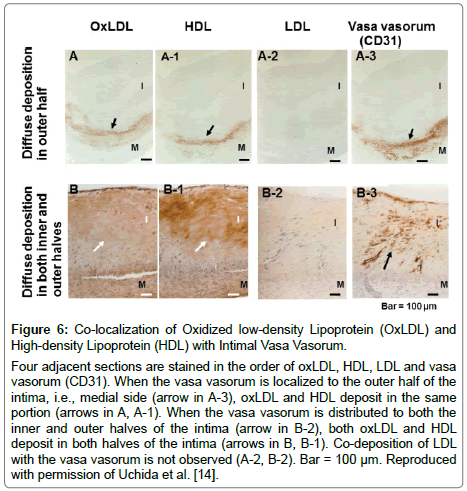 cardiovascular-research-Vasa-Vasorum