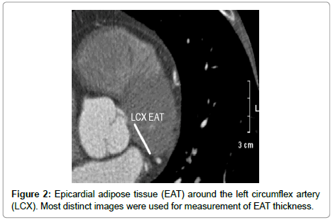 cardiovascular-research-adipose-tissue