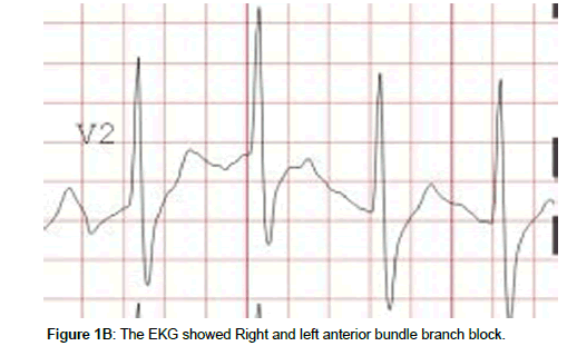cardiovascular-research-bundle-branch