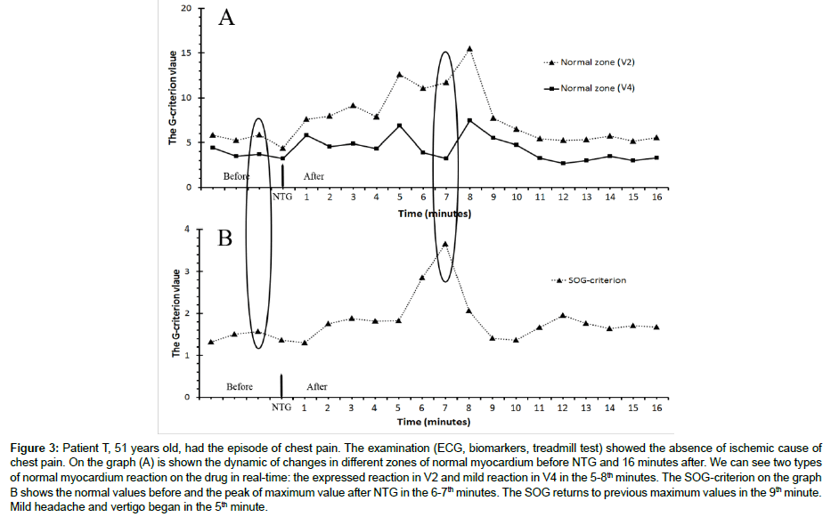 cardiovascular-research-chest-pain