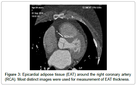 cardiovascular-research-coronary-artery