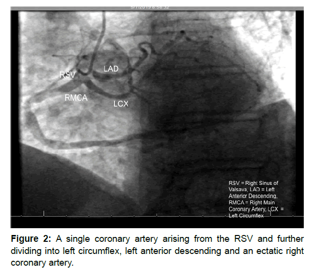cardiovascular-research-coronary-artery
