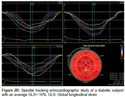 cardiovascular-research-diabetic-subject