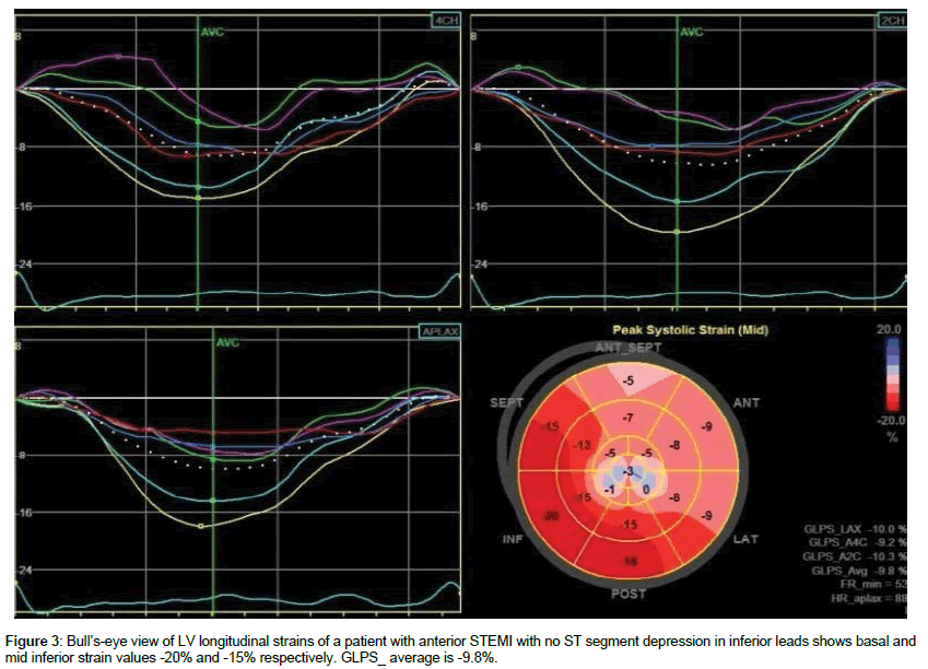 cardiovascular-research-eye-view