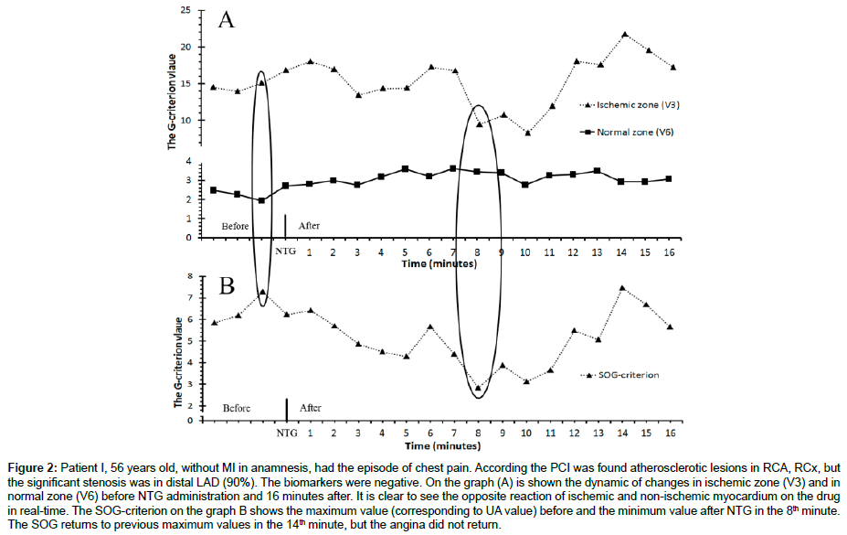 cardiovascular-research-ischemic-zone