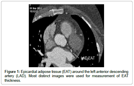 cardiovascular-research-left-anterior