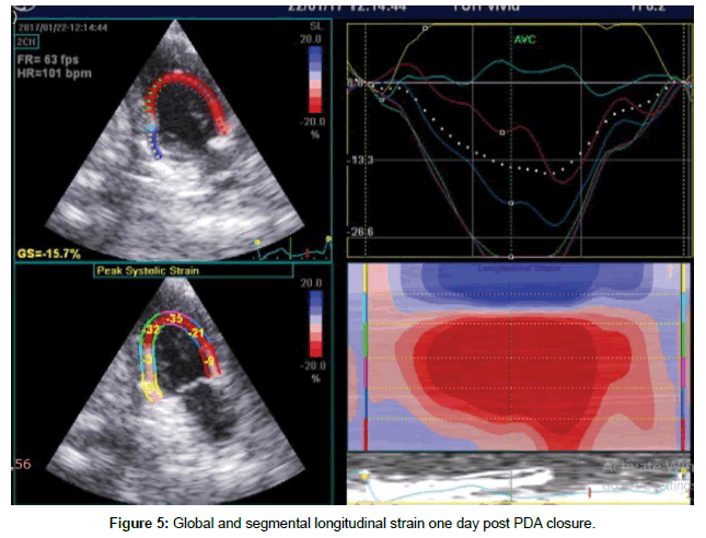 cardiovascular-research-longitudinal-strain