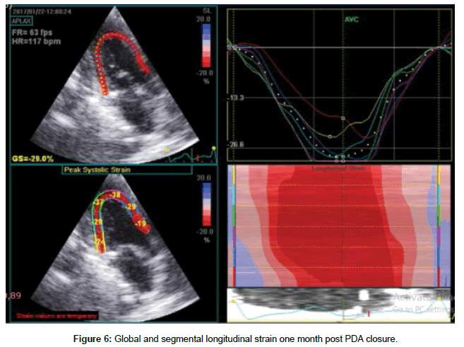 cardiovascular-research-segmental-longitudinal