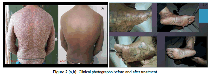 clinical-dermatology-Clinical-photographs