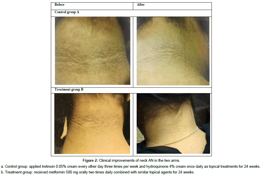 clinical-dermatology-Control-group