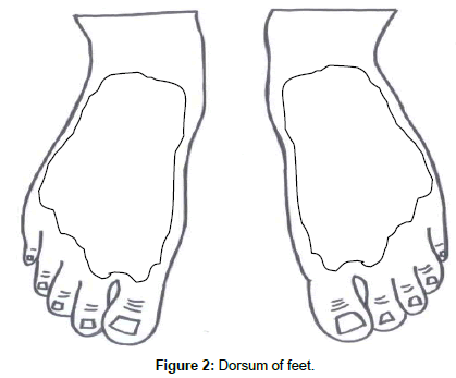 clinical-dermatology-Dorsum-feet