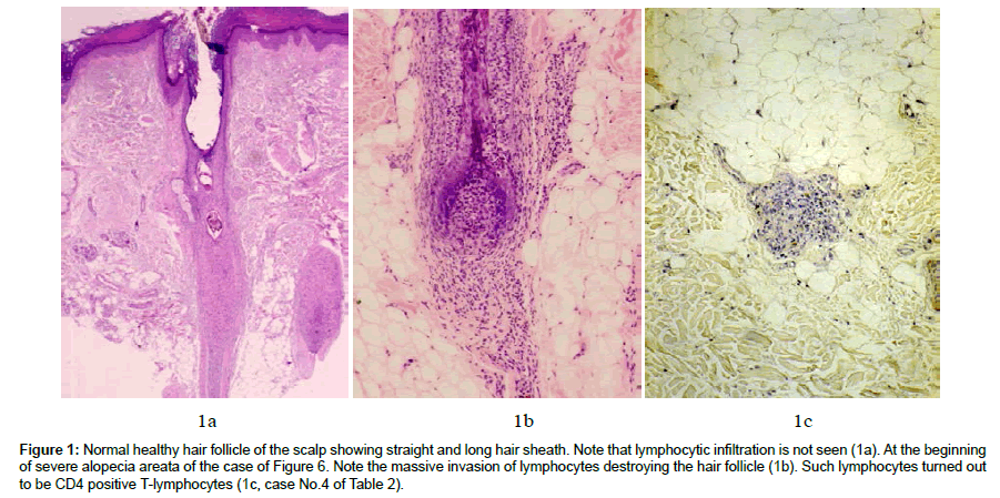 clinical-dermatology-Normal-healthy