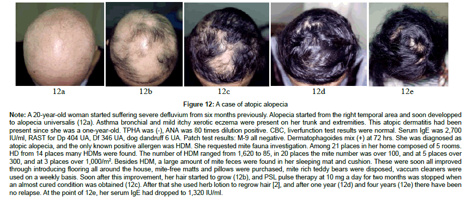 clinical-dermatology-atopic-alopecia