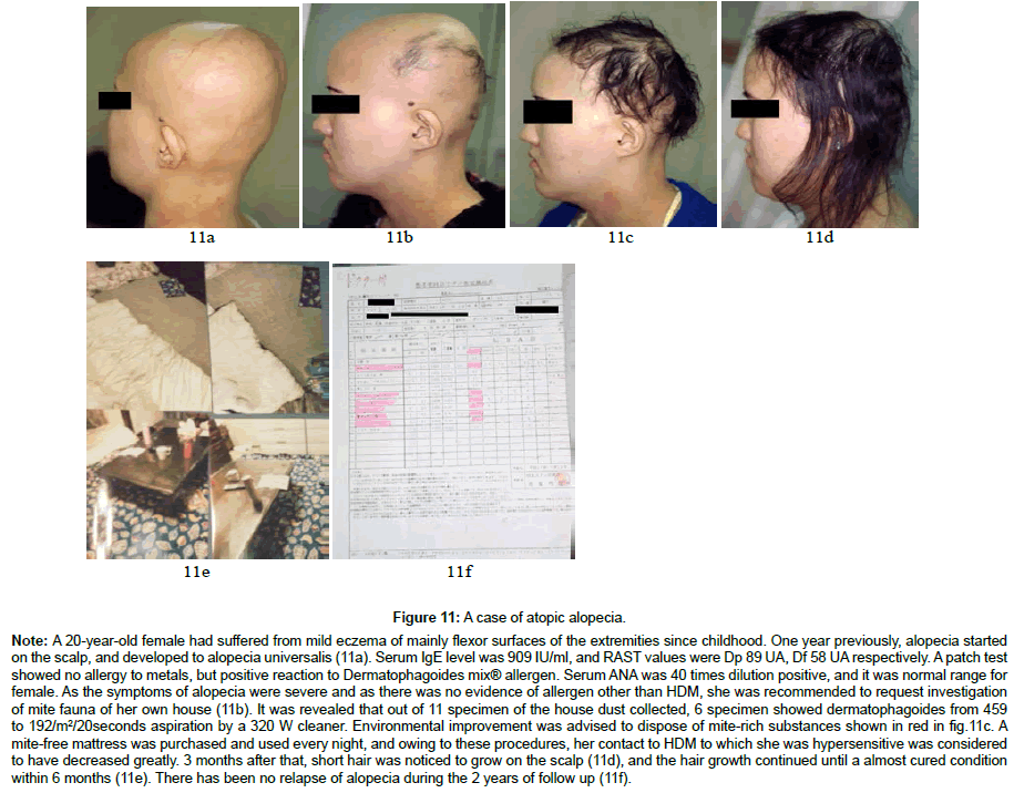 clinical-dermatology-case-alopecia
