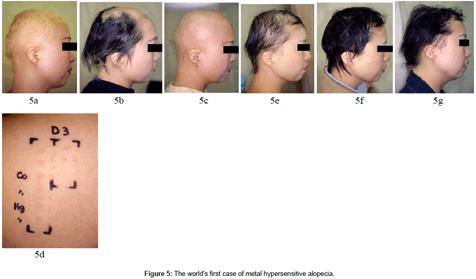 clinical-dermatology-first-case