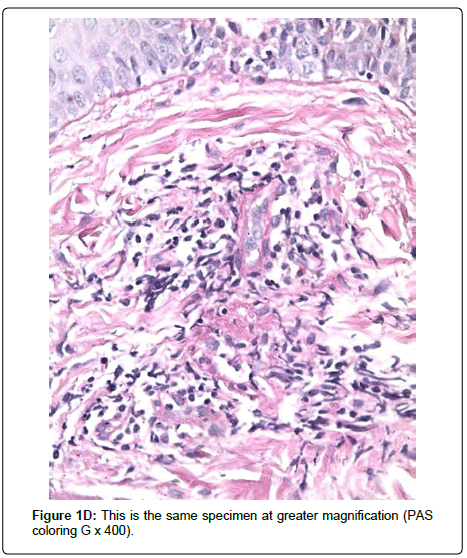 clinical-dermatology-greater-magnification