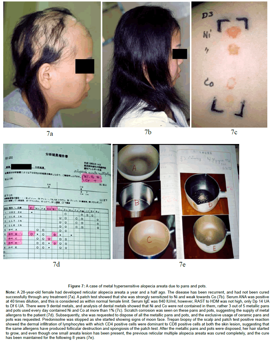 clinical-dermatology-hypersensitive