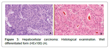 clinical-experimental-oncology-histological-examination