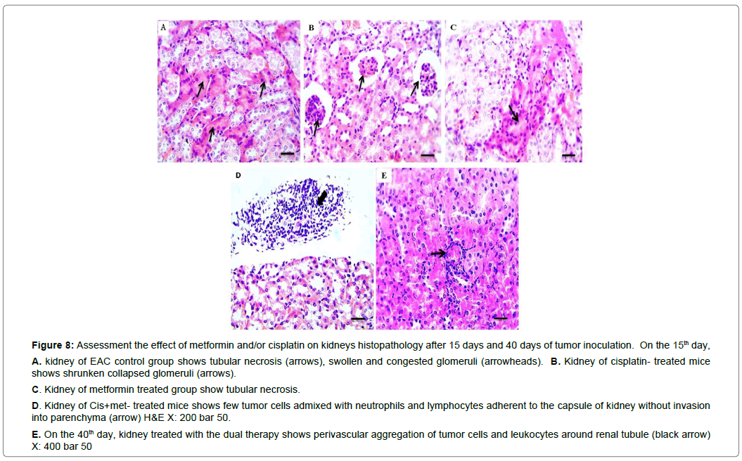 clinical-experimental-oncology-kidneys-histopathology