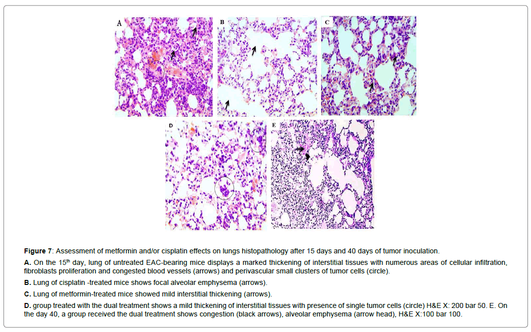 clinical-experimental-oncology-lungs-histopathology