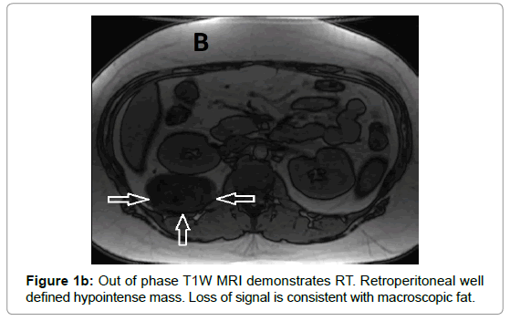 clinical-experimental-radiology-MRI-demonstrates