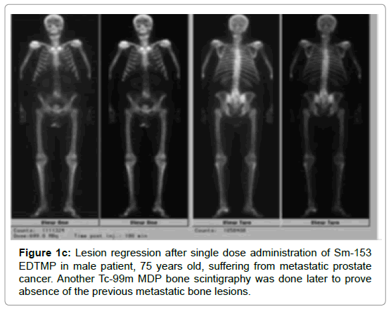 clinical-experimental-radiology-bone-scintigraphy