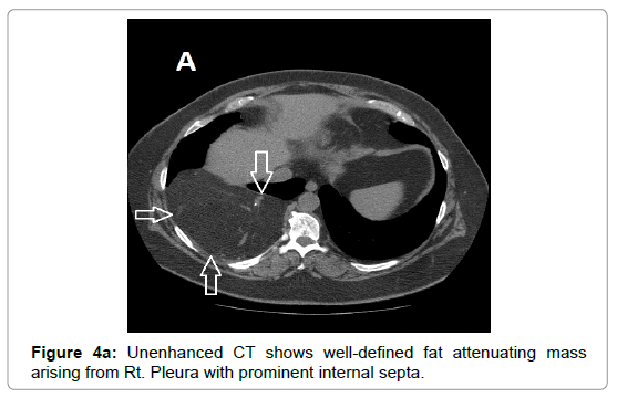 clinical-experimental-radiology-internal-septa