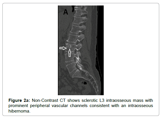 clinical-experimental-radiology-intraosseous-mass