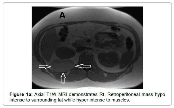 clinical-experimental-radiology-mass-hypointense