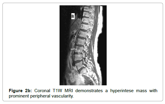 clinical-experimental-radiology-peripheral-vascularity