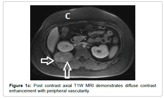 clinical-experimental-radiology-post-contrast