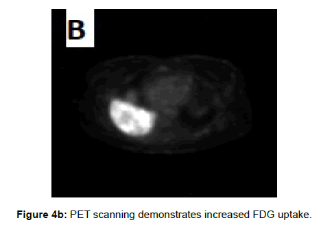 clinical-experimental-radiology-scanning-demonstrates