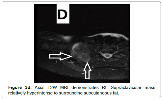 clinical-experimental-radiology-subcutaneous-fat