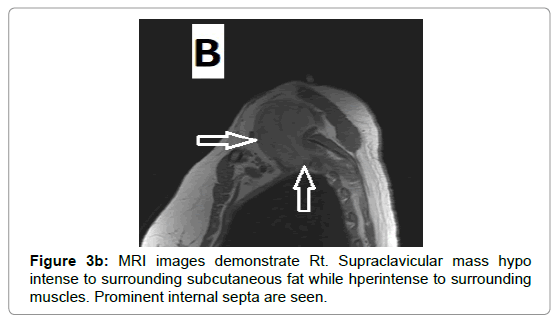 clinical-experimental-radiology-supraclavicular-mass