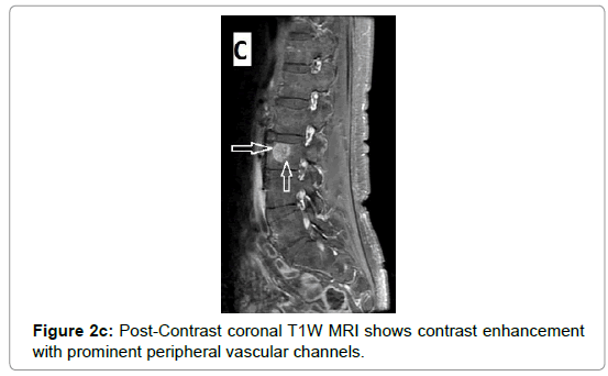 clinical-experimental-radiology-vascular-channels