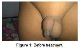clinical-images-case-reports-Before-treatment