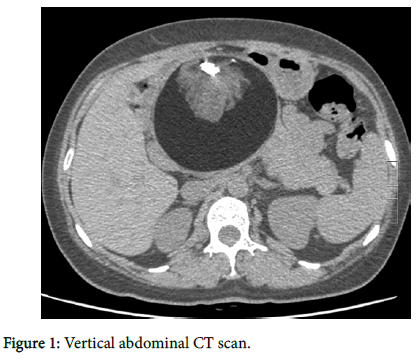 clinical-images-case-reports-CT-scan