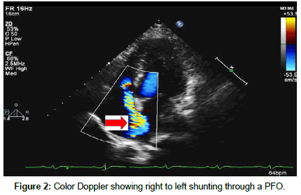 clinical-images-case-reports-Color-Doppler