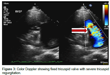 clinical-images-case-reports-Doppler
